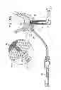 Fig. 30 - DENTAL IMPLANTS, TOOLS, AND METHODS