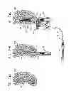Fig. 36 - DENTAL IMPLANTS, TOOLS, AND METHODS