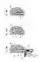Fig. 37 - DENTAL IMPLANTS, TOOLS, AND METHODS