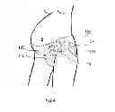 Fig. 04 - MATERNITY GARMENT
