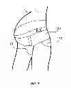 Fig. 06 - MATERNITY GARMENT
