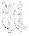 Fig. 10 - Golf Swing Measurement and Analysis System