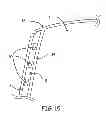 Fig. 16 - Golf Swing Measurement and Analysis System