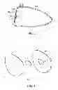 Fig. 03 - GOLF CLUB HEAD WITH MULTI-MATERIAL FACE