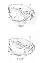 Fig. 12 - GOLF CLUB HEAD WITH MULTI-MATERIAL FACE