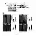 Fig. 03 - Compounds for treating cardiac damage after ischaemia/reperfusion