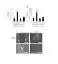 Fig. 02 - COMPOSITIONS AND METHODS FOR PREVENTING AND TREATING ORGAN INJURY AND/OR DYSFUNCTION