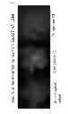 Fig. 10 - Agent for treatment of eye diseases
