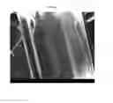 Fig. 05 - Formulations of deoxycholic acid and salts thereof