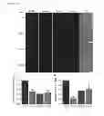 Fig. 05 - Methods of detecting amyotrophic lateral sclerosis (ALS)