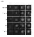 Fig. 12 - Methods of detecting amyotrophic lateral sclerosis (ALS)