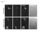 Fig. 14 - Methods of detecting amyotrophic lateral sclerosis (ALS)