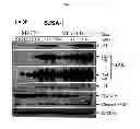 Fig. 09 - Spiro-oxindole MDM2 antagonists