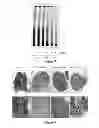 Fig. 07 - Small molecule therapeutic compounds targeting thioesterase deficiency disorders and methods of using the same