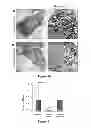 Fig. 08 - Small molecule therapeutic compounds targeting thioesterase deficiency disorders and methods of using the same