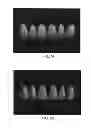 Fig. 08 - Dental bonding agent and coating agent