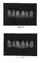 Fig. 09 - Dental bonding agent and coating agent