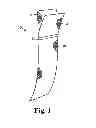Fig. 02 - Implantable article and method