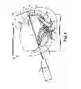 Fig. 03 - Implantable article and method