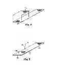 Fig. 07 - Implantable article and method