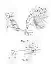 Fig. 03 - Organ manipulator apparatus