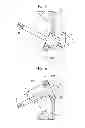 Fig. 06 - Wire-pulling mechanism and endoscopic apparatus