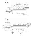 Fig. 02 - NOVEL BUMPED DILATOR TIP