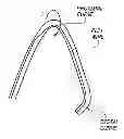 Fig. 01 - METHOD OF ANCHORING PULLWIRE DIRECTLY ARTICULATABLE REGION IN CATHETER