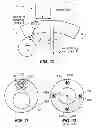 Fig. 10 - METHOD OF ANCHORING PULLWIRE DIRECTLY ARTICULATABLE REGION IN CATHETER