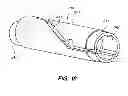 Fig. 13 - METHOD OF ANCHORING PULLWIRE DIRECTLY ARTICULATABLE REGION IN CATHETER