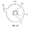 Fig. 30 - METHOD OF ANCHORING PULLWIRE DIRECTLY ARTICULATABLE REGION IN CATHETER