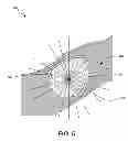 Fig. 06 - Methods and systems for determining tumor boundary characteristics