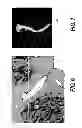 Fig. 06 - Method and system for patient-specific modeling of blood flow