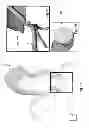 Fig. 12 - Method and system for patient-specific modeling of blood flow