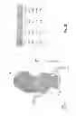 Fig. 17 - Method and system for patient-specific modeling of blood flow