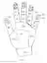 Fig. 07 - Method for examining the surface temperature of a body part