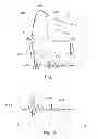 Fig. 02 - Implantable medical device with active detection of atrial mechanical activity