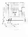 Fig. 02 - Acute ischemia detection based on parameter value range analysis