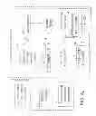 Fig. 05 - Acute ischemia detection based on parameter value range analysis