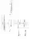 Fig. 06 - Acute ischemia detection based on parameter value range analysis