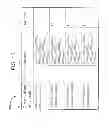 Fig. 24 - Acute ischemia detection based on parameter value range analysis