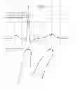 Fig. 01 - Multi-touch approach for ECG measurement