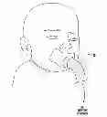 Fig. 01 - NEBULIZER THAT IS ACTIVATED BY NEGATIVE INSPIRATORY PRESSURE