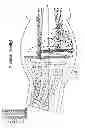 Fig. 07 - NEBULIZER THAT IS ACTIVATED BY NEGATIVE INSPIRATORY PRESSURE