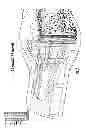 Fig. 08 - NEBULIZER THAT IS ACTIVATED BY NEGATIVE INSPIRATORY PRESSURE