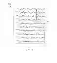 Fig. 07 - Method And System For Displaying The Amount Of Artifact Present In An EEG Recording
