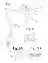 Fig. 02 - Gastric sizing systems including instruments for use in bariatric surgery