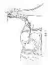 Fig. 04 - COLONOSCOPY SYSTEMS AND METHODS