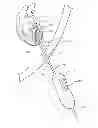 Fig. 01 - DEVICE AND METHOD FOR SALVAGING MYOCARDIUM FOLLOWING HEART ATTACK