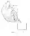 Fig. 02 - DEVICE AND METHOD FOR SALVAGING MYOCARDIUM FOLLOWING HEART ATTACK